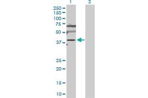 Western Blot analysis of SLC25A6 expression in transfected 293T cell line by SLC25A6 MaxPab polyclonal antibody.
