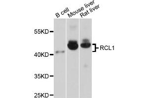 Western blot analysis of extracts of various cell lines, using RCL1 antibody (ABIN1875879) at 1:1000 dilution. (RCL1 anticorps)