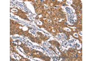 Immunohistochemistry of Human brain  using CYLD Polyclonal Antibody at dilution of 1:35 (CYLD anticorps)