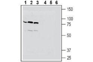 Western blot analysis of human THP-1 monocytic leukemia cell line lysates (lanes 1 and 4), mouse BV-2 microglia cell line lysates (lanes 2 and 5) and human HeLa cervix adenocarcinoma cell line lysates (lanes 3 and 6): - 1-3. (SLC22A4 anticorps  (C-Term, Intracellular))
