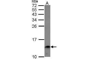 WB Image Sample (30 ug of whole cell lysate) A: A549 15% SDS PAGE antibody diluted at 1:1000 (Ensa anticorps)
