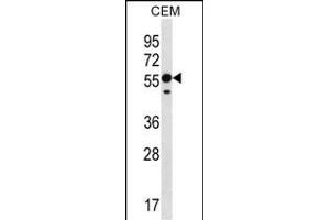 RNF8 Antibody (C-term) (ABIN657354 and ABIN2846404) western blot analysis in CEM cell line lysates (35 μg/lane). (RNF8 anticorps  (C-Term))