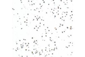 Immunocytochemistry (ICC) image for anti-Enhancer of Zeste Homolog 2 (EZH2) (AA 1-154) antibody (ABIN7795766) (Recombinant EZH2 anticorps  (AA 1-154))
