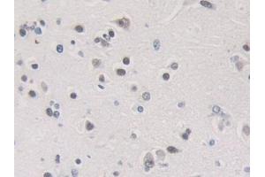Detection of HNRNPA1 in Human Brain Tissue using Polyclonal Antibody to Heterogeneous Nuclear Ribonucleoprotein A1 (HNRNPA1)