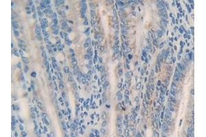 Detection of MGST1 in Mouse Intestine Tissue using Polyclonal Antibody to Microsomal Glutathione S Transferase 1 (MGST1)