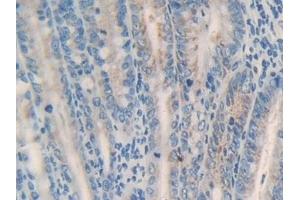 Detection of MGST1 in Mouse Intestine Tissue using Polyclonal Antibody to Microsomal Glutathione S Transferase 1 (MGST1) (MGST1 anticorps  (AA 8-155))
