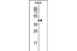 Western blot analysis of anti-PTPN7 Antibody (S44) (ABIN391869 and ABIN2841694) in Jurkat cell line lysates (35 μg/lane). (PTPN7 anticorps  (AA 22-51))