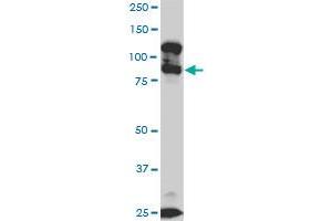 KSR2 monoclonal antibody (M05), clone 5C4. (KSR2 anticorps  (AA 411-500))