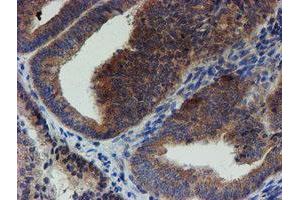 Image no. 2 for anti-Zinc Finger Protein 365 (ZNF365) (AA 108-407) antibody (ABIN1490829)