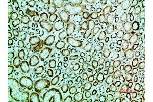 Immunohistochemical analysis of paraffin-embedded human-kidney, antibody was diluted at 1:200 (IRF3 anticorps  (AA 1268-1341))