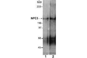 Western blot analysis of Npc1l1 in rat small intestine membrane preparations (Lane 1 : 2 ug/mL , Lane 2 : 4 ug/mL) with Npc1l1 polyclonal antibody . (NPC1L1 anticorps  (AA 1000-1100))