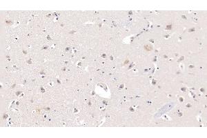 Detection of APOL2 in Human Cerebrum Tissue using Monoclonal Antibody to Apolipoprotein L2 (APOL2)