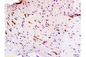 Formalin-fixed and paraffin embedded rat brain labeled with Anti-Sema3F/semaphorin 3F Polyclonal Antibody, Unconjugated  at 1:200 followed by conjugation to the secondary antibody and DAB staining. (SEMA3F anticorps  (AA 651-754))