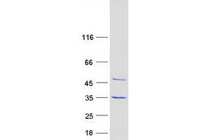 Validation with Western Blot