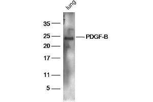 Mouse lung lysates probed with Rabbit Anti-PDGF-B Polyclonal Antibody, Unconjugated  at 1:5000 for 90 min at 37˚C. (PDGFB anticorps  (AA 155-210))