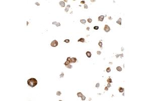 Immunocytochemistry (ICC) image for anti-Myc Tag (AA 410-419) antibody (ABIN7453372) (Recombinant Myc Tag anticorps  (AA 410-419))
