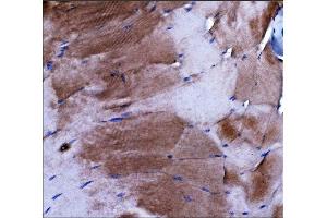 IHC analysis of Dysferlin/DYSF using anti-Dysferlin/DYSF antibody (ABIN7601939).