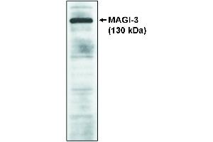 Western blot analysis using MAGI-3, GKWW antibody on cell lysates transfected with full-length human MAGI-3 protein.