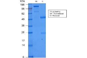 SDS-PAGE Analysis of Purified CD86 Rabbit Recombinant Monoclonal Antibody (C86/2160R).