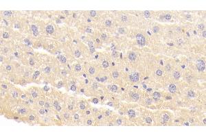 Detection of BFP in Mouse Liver Tissue using Polyclonal Antibody to Brain Finger Protein (BFP)
