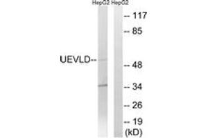Western blot analysis of extracts from HepG2 cells, using UEVLD Antibody. (UEVLD anticorps  (AA 141-190))