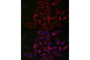Immunofluorescence analysis of U2OS cells using TRIP2 Rabbit pAb (ABIN6129947, ABIN6149464, ABIN6149465 and ABIN6222516) at dilution of 1:50 (40x lens).