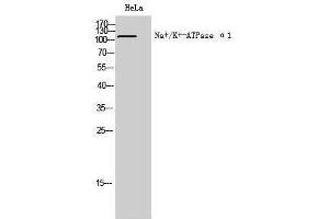 Western Blotting (WB) image for anti-Sodium Potassium ATPase, alpha1 (ATP1A1) (Ser23) antibody (ABIN3185759) (ATP1A1 anticorps  (Ser23))