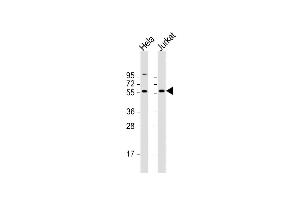All lanes : Anti-CREB3L2 Antibody (C-term) at 1:2000 dilution Lane 1: Hela whole cell lysate Lane 2: Jurkat whole cell lysate Lysates/proteins at 20 μg per lane. (CREB3L2 anticorps  (C-Term))