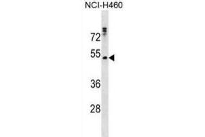 Western Blotting (WB) image for anti-Rh Family C Glycoprotein (RHCG) antibody (ABIN3000734) (RHCG anticorps)