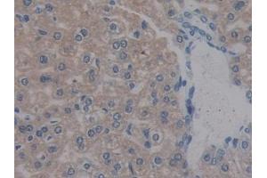 Detection of REG3b in Mouse Liver Tissue using Polyclonal Antibody to Regenerating Islet Derived Protein 3 Beta (REG3b)