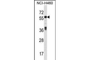 ICA1 Antibody (N-term) (ABIN1539626 and ABIN2848494) western blot analysis in NCI- cell line lysates (35 μg/lane).