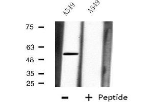 Western blot analysis of extracts from A549 cells, using CPM antibody.