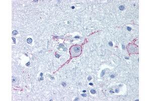Anti-GALR3 antibody IHC of human brain, cortex. (GALR3 anticorps  (Extracellular Domain))