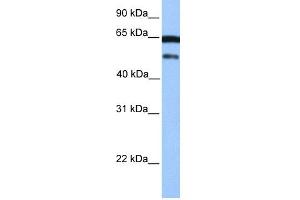 WB Suggested Anti-hCG_2042202 Antibody Titration:  0.