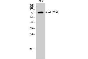 Western Blotting (WB) image for anti-Spleen tyrosine Kinase (SYK) (pTyr348) antibody (ABIN3182500)