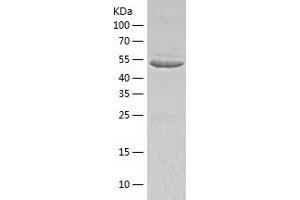 Western Blotting (WB) image for Target of Myb1-Like 2 (TOM1L2) (AA 1-507) protein (His tag) (ABIN7125318) (TOM1L2 Protein (AA 1-507) (His tag))