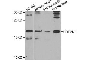 Western blot analysis of extracts of various cell lines, using UBE2NL antibody. (UBE2NL anticorps  (AA 1-100))