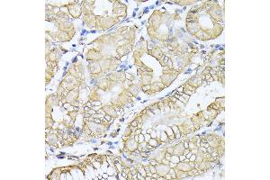 Immunohistochemistry of paraffin-embedded human stomach using Alpha Fodrin antibody (ABIN6128747, ABIN6148403, ABIN6148404 and ABIN6213643) at dilution of 1:100 (40x lens).