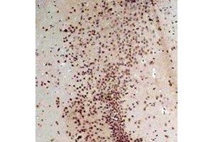 Immunohistochemical analysis of CACNA2D1 staining in rat brain formalin fixed paraffin embedded tissue section.