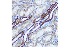 Immunohistochemistry of paraffin-embedded Rat kidney using GSTT1 Rabbit pAb (ABIN3021870, ABIN3021871, ABIN3021872, ABIN1512971 and ABIN6216656) at dilution of 1:100 (40x lens).