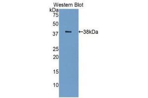 Western Blotting (WB) image for anti-Lectin, Galactoside-Binding, Soluble, 8 (LGALS8) (AA 1-317) antibody (ABIN1078059)