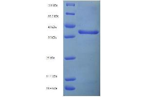 SDS-PAGE of protein expressed in E.