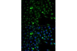 Immunofluorescence analysis of A549 cell using ALDH1A1 antibody. (ALDH1A1 anticorps  (AA 48-147))