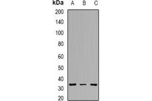 Western blot analysis of Tropomyosin 2 expression in Hela (A), MCF7 (B), mouse lung (C) whole cell lysates. (TPM2 anticorps)