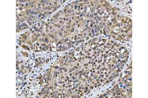 IHC analysis of SCML1 using anti-SCML1 antibody (ABIN7602479). (SCML1 anticorps  (AA 8-322))