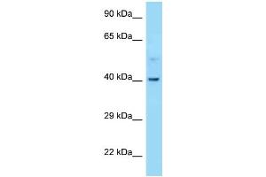 WB Suggested Anti-CNR2 Antibody Titration: 1. (CNR2 anticorps  (C-Term))