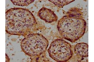 IHC image of ABIN7174015 diluted at 1:100 and staining in paraffin-embedded human placenta tissue performed on a Leica BondTM system.