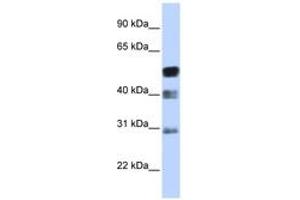Image no. 1 for anti-Transcription Factor AP-2 beta (Activating Enhancer Binding Protein 2 Beta) (TFAP2B) (AA 35-84) antibody (ABIN6742379) (TFAP2B anticorps  (AA 35-84))