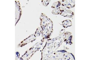 Immunohistochemistry of paraffin-embedded human placenta using HD Rabbit pAb (ABIN3022053, ABIN3022054, ABIN3022055 and ABIN6218586) at dilution of 1:25 (40x lens).