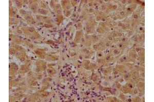 IHC image of ABIN7146046 diluted at 1:100 and staining in paraffin-embedded human liver tissue performed on a Leica BondTM system. (CLEC1A anticorps  (AA 66-316))